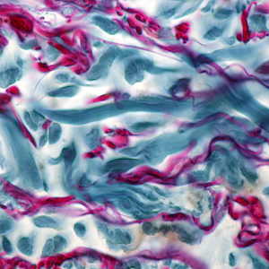 Real-time Accessible Reports